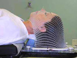 Mesh Mask for Brain Cancer Treatment